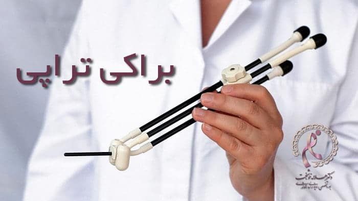 براکی تراپی