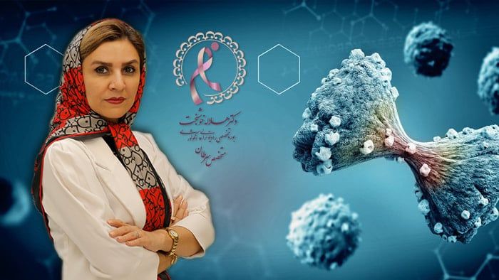 بهترین متخصص سرطان سینه