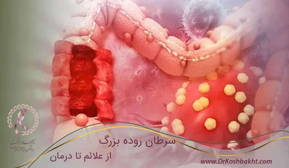 سرطان-روده-بزرگ-از-علائم-تا-درمان