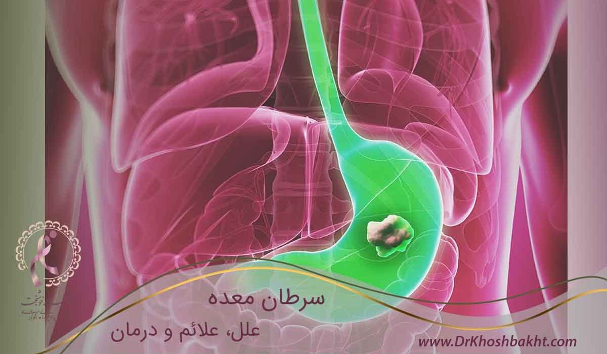 سرطان-معده؛-علل-علائم-و-درمان